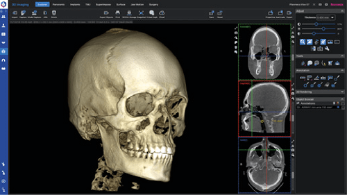 planmeca-viso-cbct-imaging