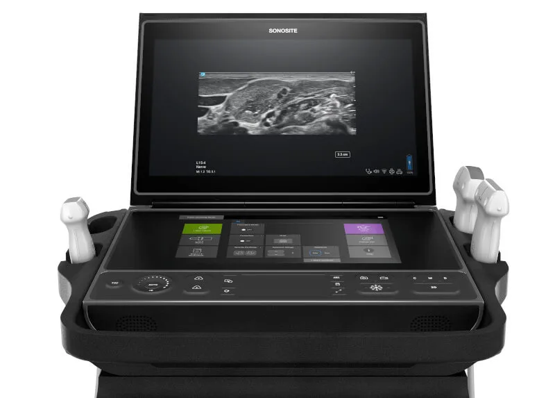 Fujifilm Sonosite ZX Ultrasound Machine | Medical Outfitters