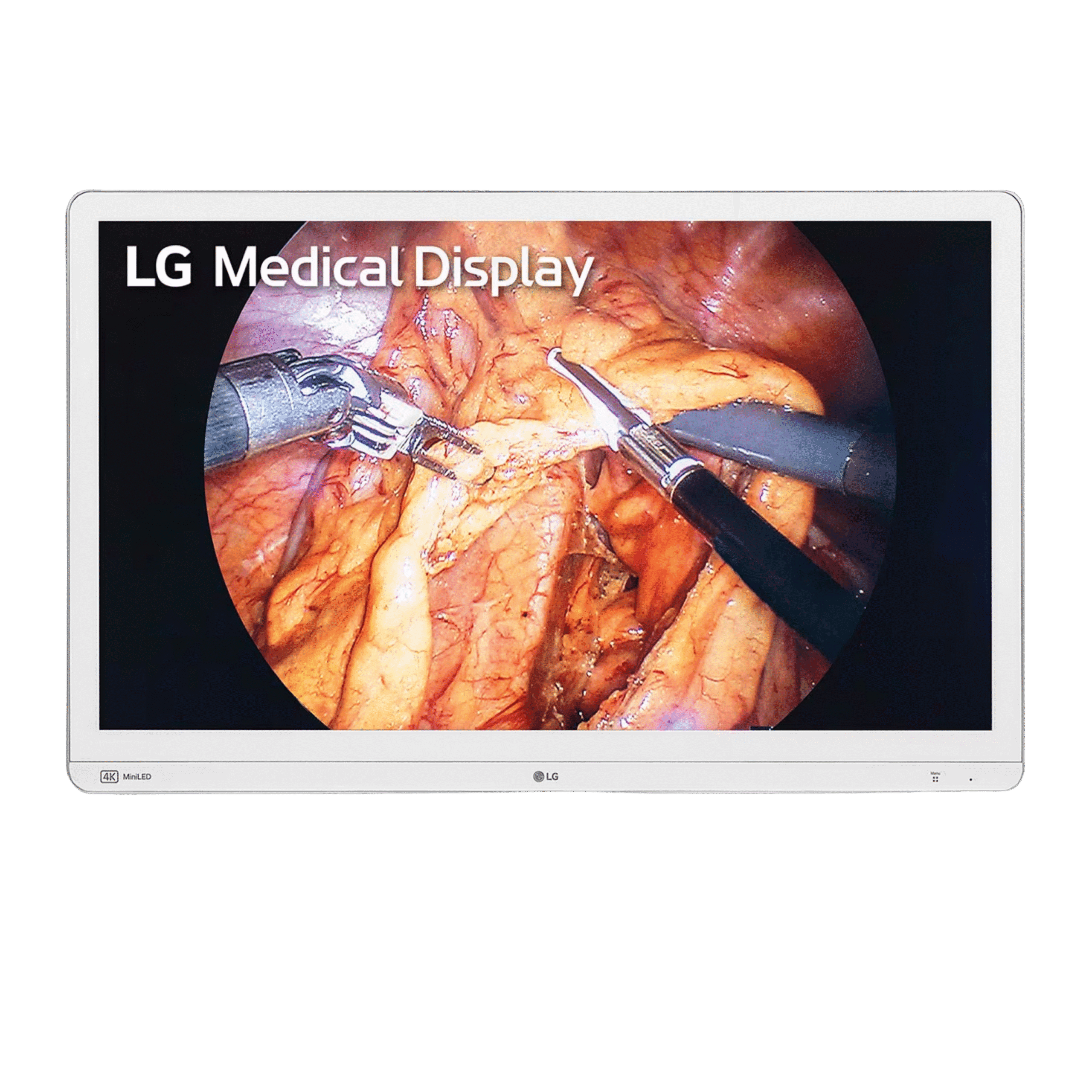 LG 32HR734S-W 31.5-inch 4K Mini-LED Surgical Monitor