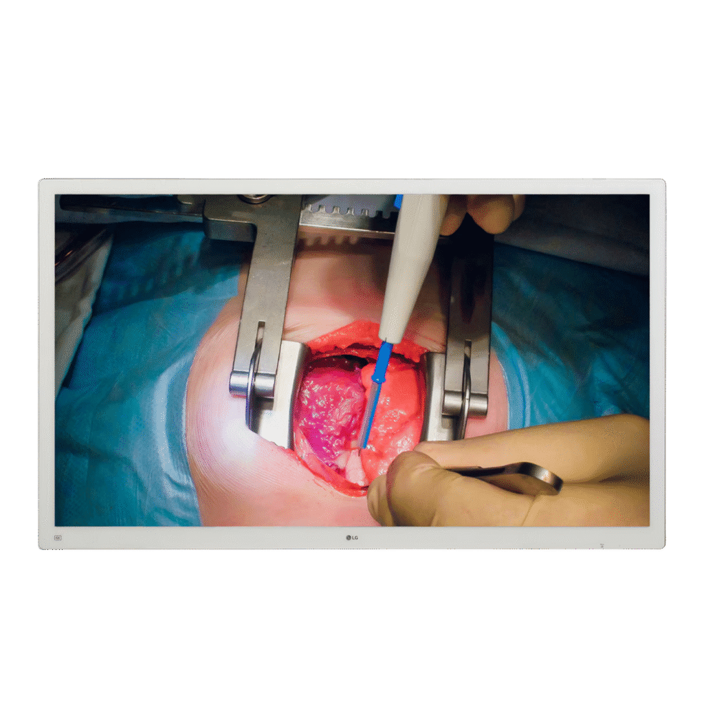 55MH5K LG 55" 4K IPS Surgical Monitor