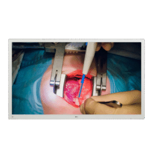 LG 55'' 4K IPS Surgical Monitor - LG 55MH5K
