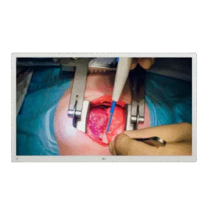 LG 55'' 4K IPS Surgical Monitor - LG 55MH5K