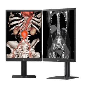 LG 21.3" 3MP IPS Diagnostic Monitor - LG 21HQ513D