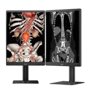 LG 21.3" 3MP IPS Diagnostic Monitor - LG 21HQ513D