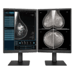 LG 21HQ613D – 21.3-inch 5MP IPS Diagnostic Monitor for Mammography – 1
