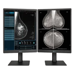 LG 21.3" 5MP IPS Diagnostic Monitor - LG 21HQ613D