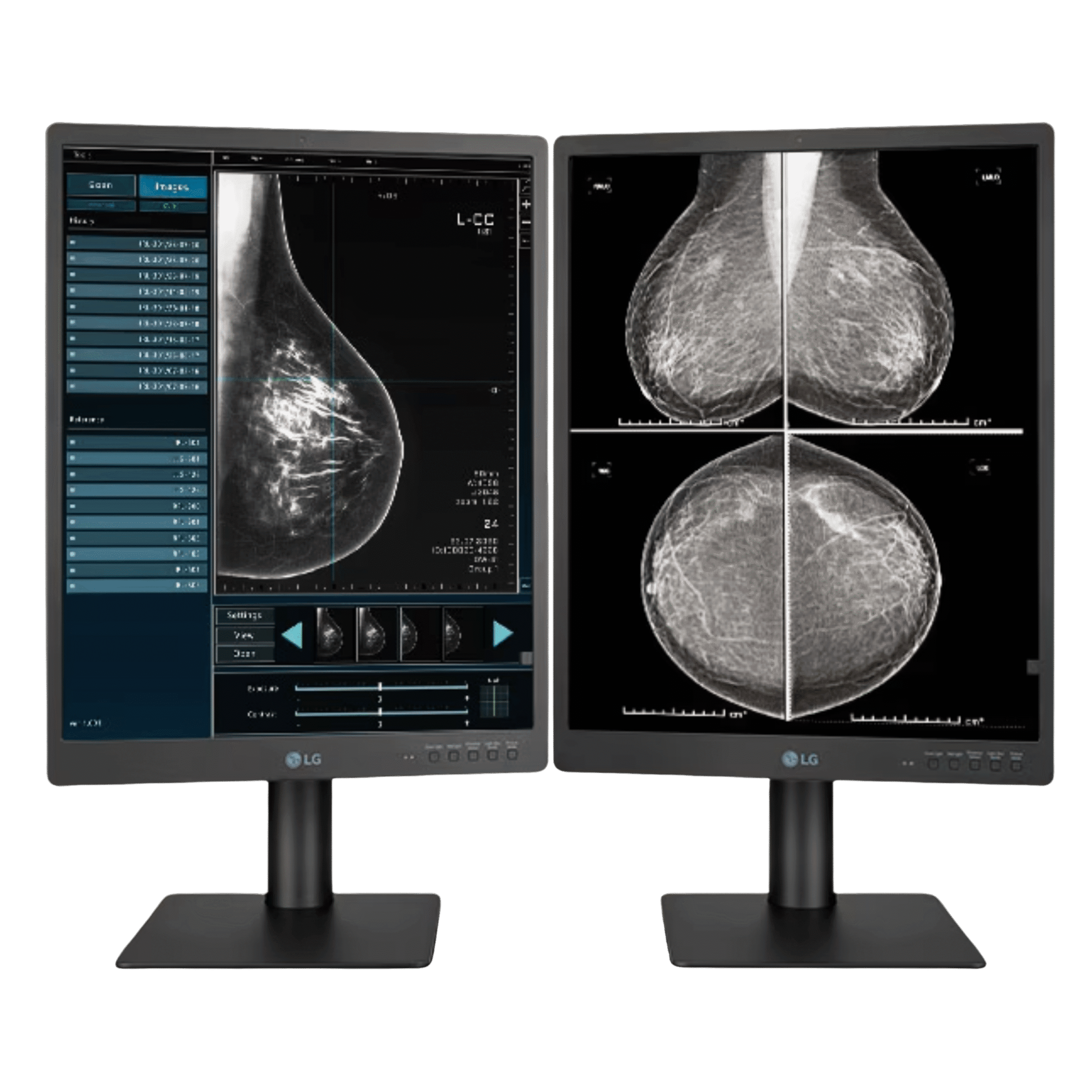 LG 21.3″ 5MP IPS Diagnostic Monitor – LG 21HQ613D