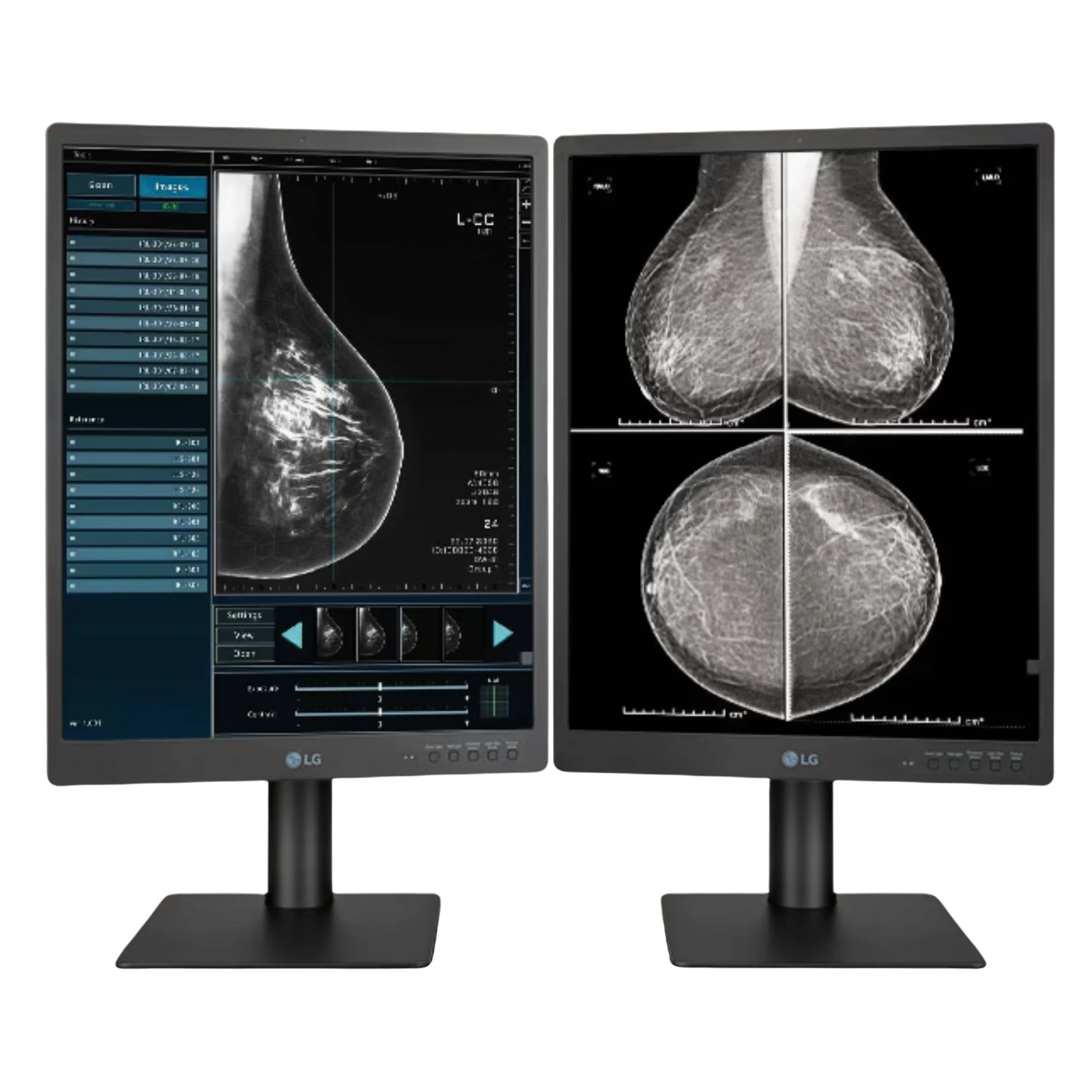 LG 21HQ613D 21.3-inch 5MP IPS Diagnostic Monitor