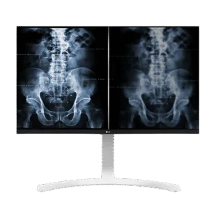 LG 27'' 8MP IPS Clinical Review Monitor - LG 27HJ712C