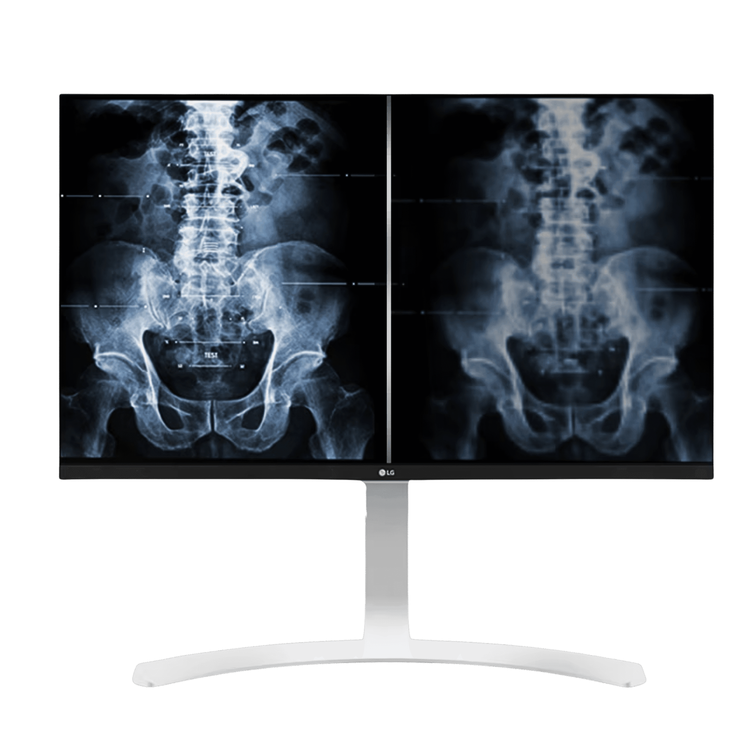 LG 27HJ712C-W 27 inch 8MP IPS Clinical Review Monitor