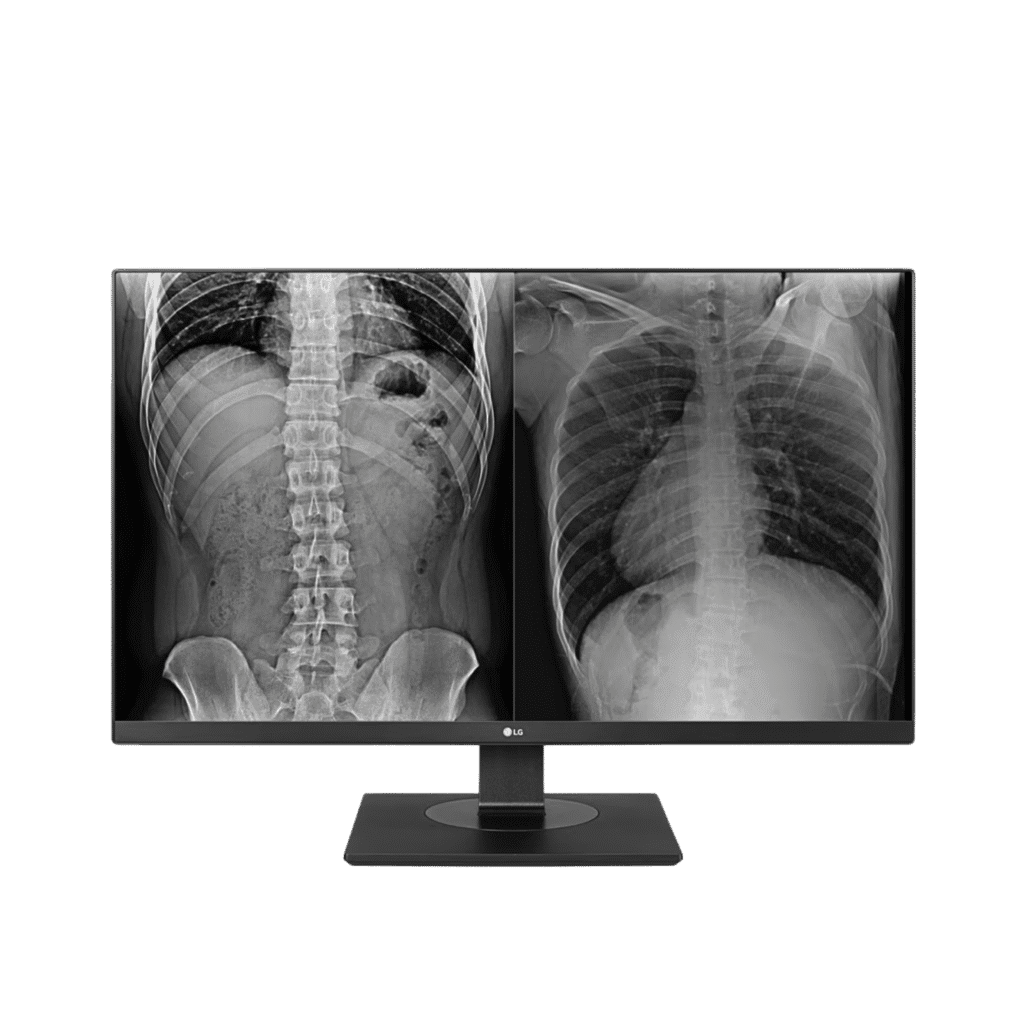 LG 27HJ713C 27_ 8MP IPS Clinical Review Monitor – 1