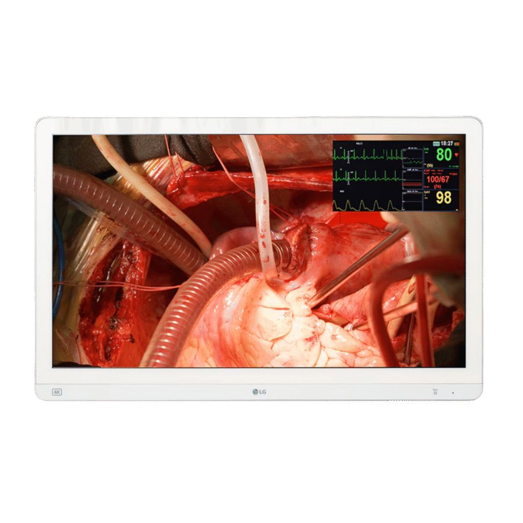 LG 27HQ710S 27-inch 4K Surgical Monitor with Mini-LED – 1