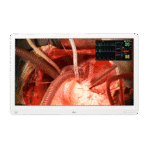 LG 27HQ710S 27-inch 4K Surgical Monitor with Mini-LED – 1