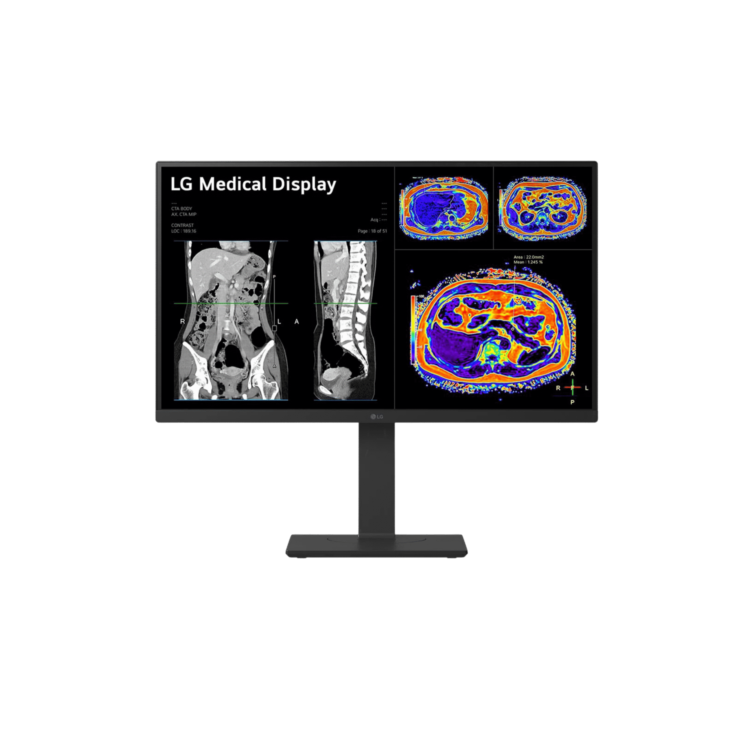 LG 27HS713C 27-inch 8MP IPS Clinical Review Monitor