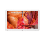 LG 27HS714S 27-inch 4K Mini-LED Surgical Monitor - Medical Outfitters