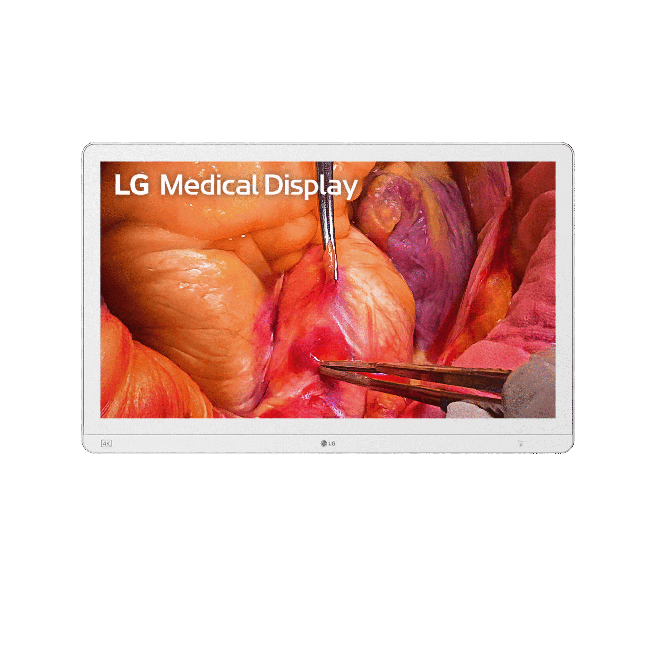 LG 27HS714S 27-inch 4K Mini-LED Surgical Monitor