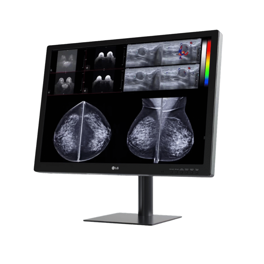 LG 31HN713D 31-inch 12MP Diagnostic Monitor for Mammography
