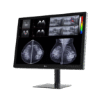 LG 31HN713D 31-inch 12MP Diagnostic Monitor for Mammography