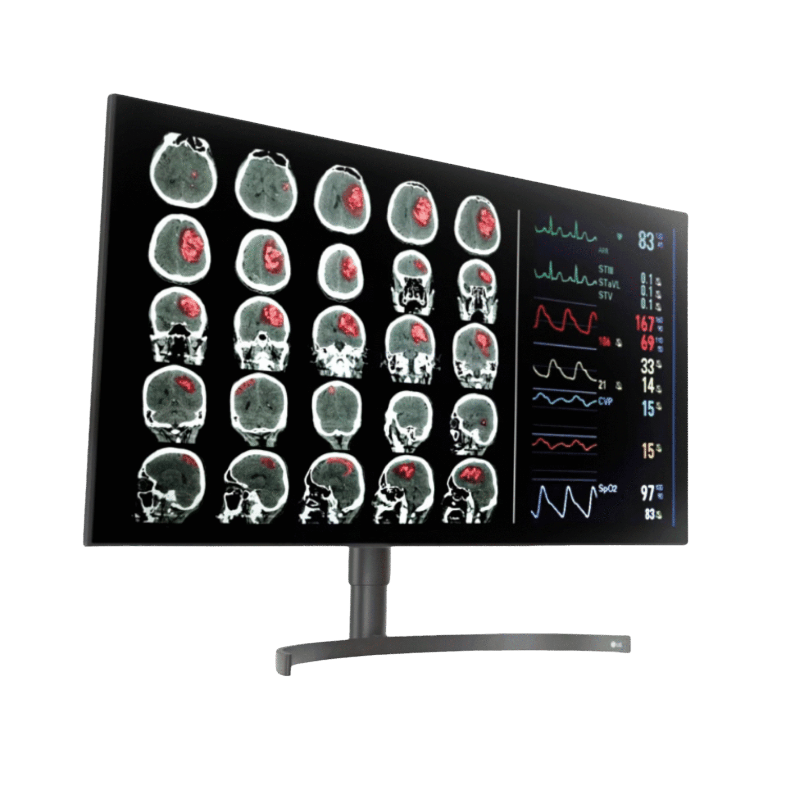 LG 32HL512D 31.5-inch 8MP Nano IPS Diagnostic Monitor
