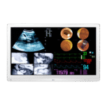 LG 32HL710S 31.5 4K IPS Surgical Monitor