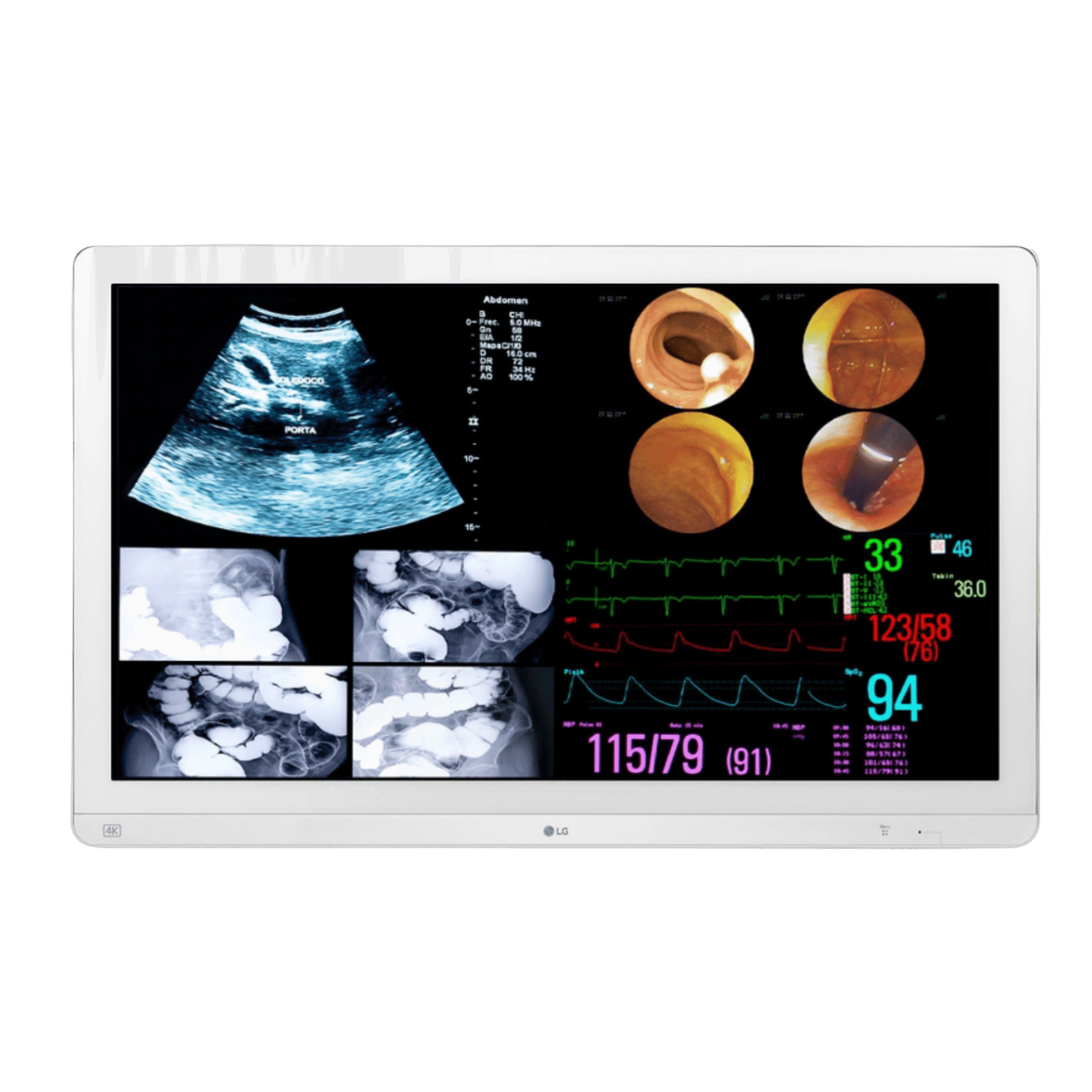 LG 32HL714S 31.5-inch 4K IPS Surgical Monitor with 12G-SDI