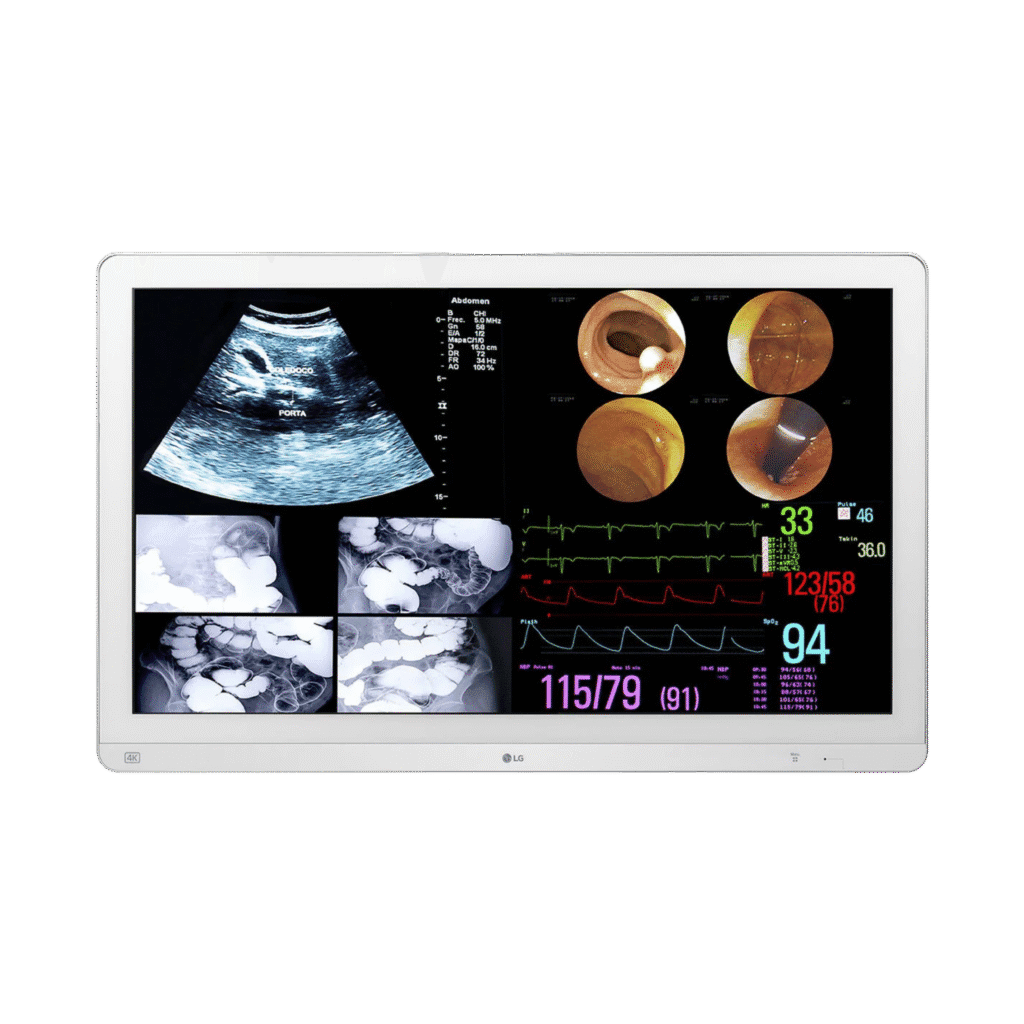 LG 32HL714S 31.5_ 4K IPS Surgical Monitor – 1
