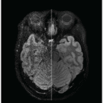 Swift MR – Medical Outfitters – AI-Powered MRI Enhancement Solution – New