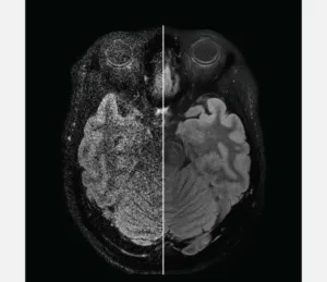 Fujifilm OASIS Velocity 1.2T Open MRI | Medical Outfitters