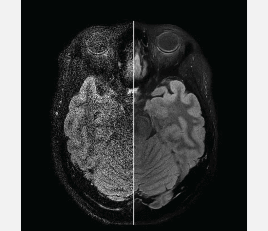 Swift MR – Medical Outfitters – AI-Powered MRI Enhancement Solution – New