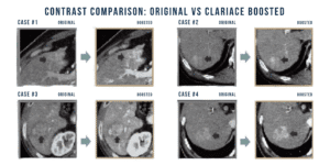 ClariACE Contrast Enhancement Software