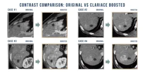 ClariACE Contrast Enhancement Software