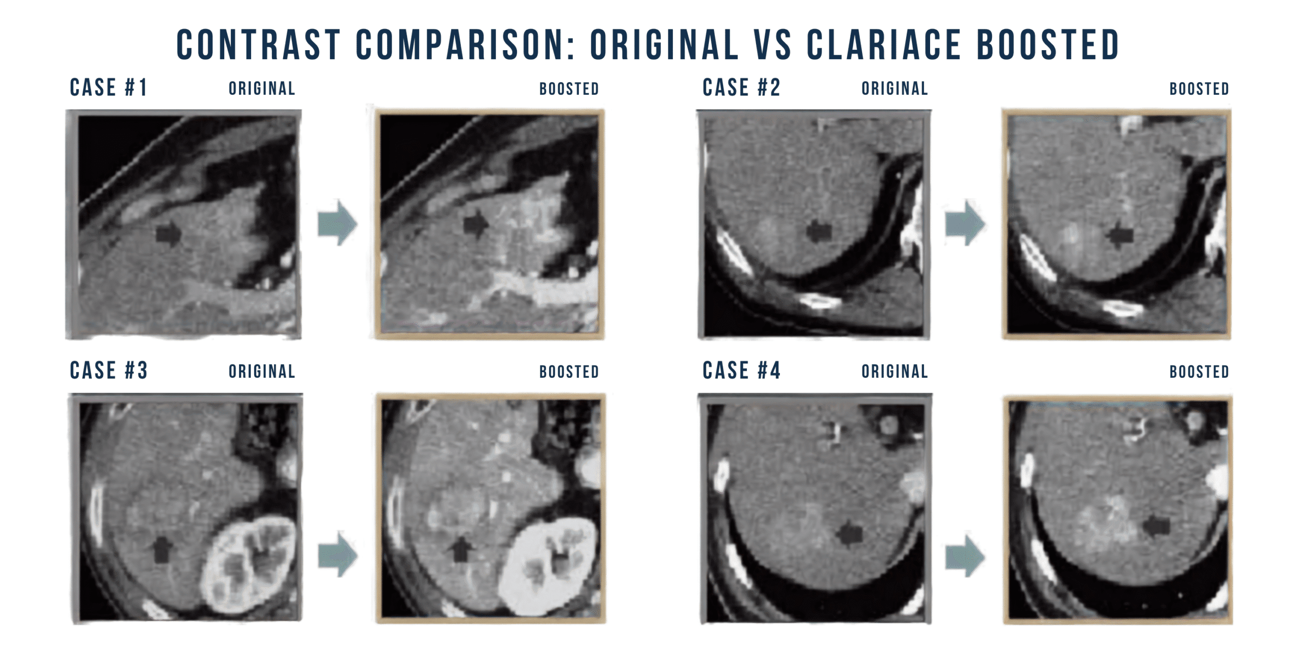 ClariACE Contrast Enhancement Software