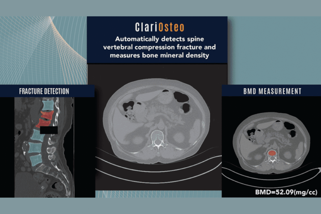 ClariOsteo-2