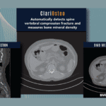 ClariOsteo-2