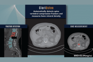 ClariOsteo System