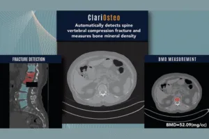 ClariOsteo System
