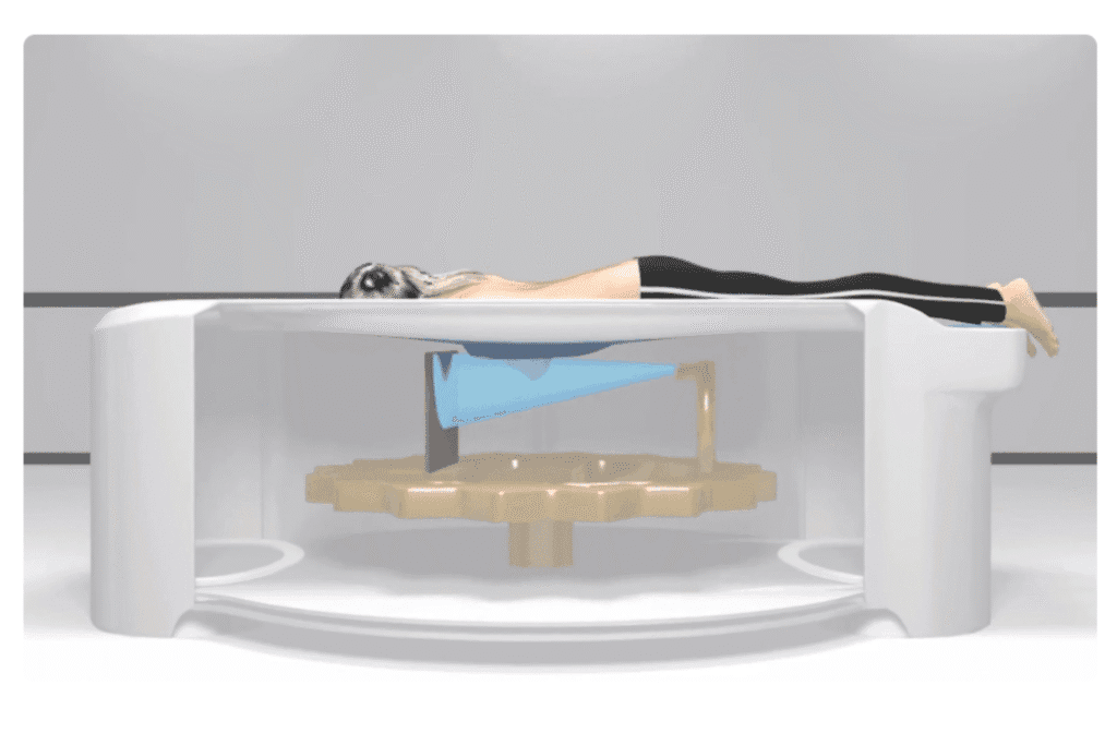 Koning-Vera-Breast-CT-2