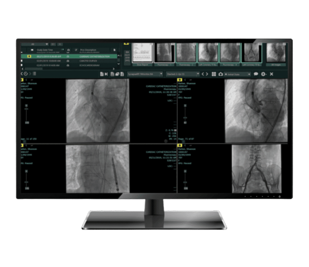 Synapse CV Product Image – Medical Outfitters – Cardiology PACS – New