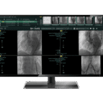 Synapse CV Product Image – Medical Outfitters – Cardiology PACS – New