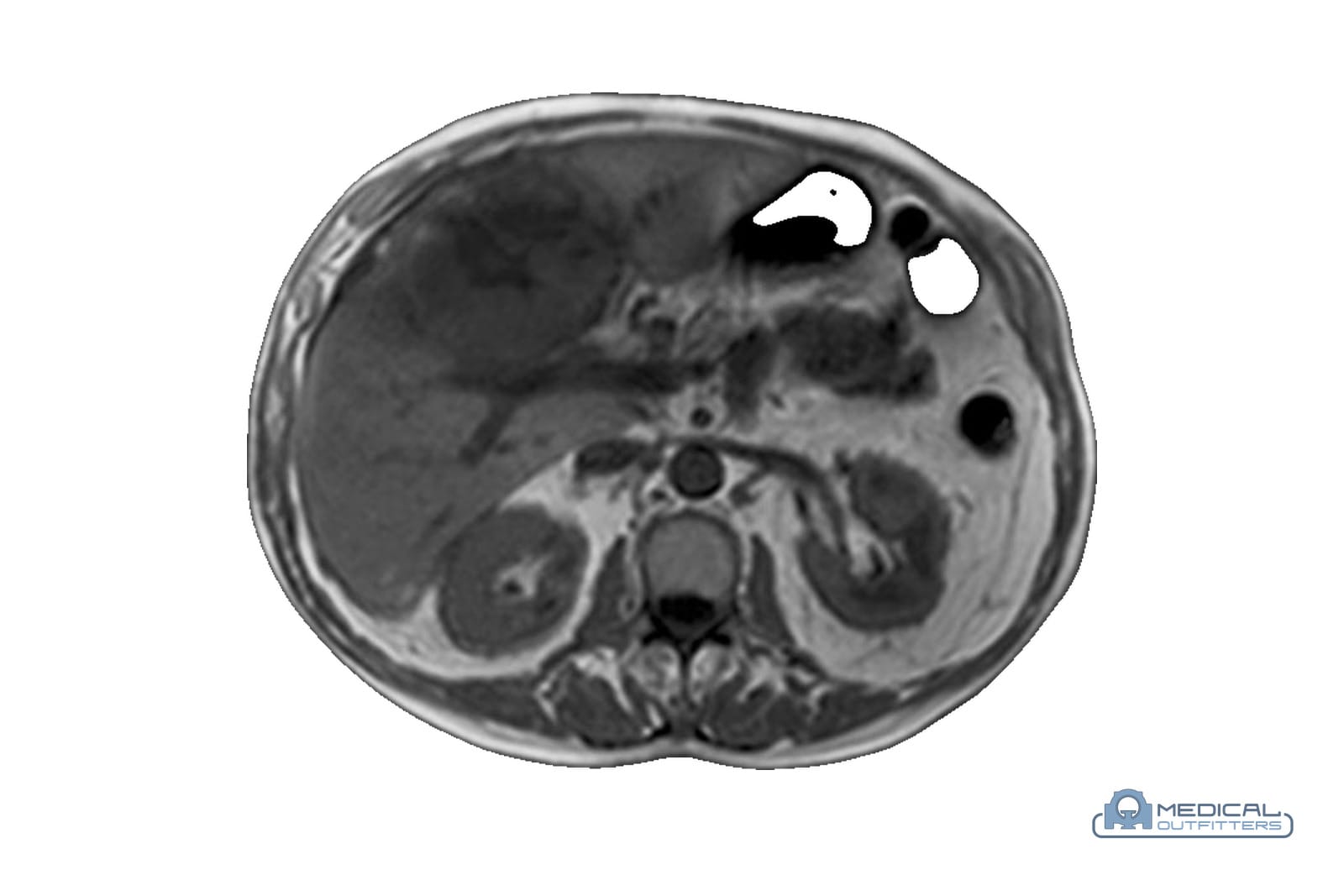 Siemens MAGNETOM Aera 1.5T wide-bore MRI, angled view with the patient table